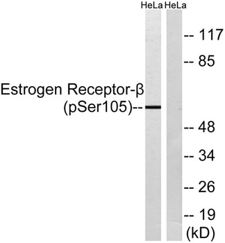 ERβ (phospho Ser105) rabbit pAb Antibody