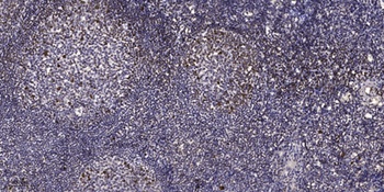 ERβ (phospho Ser87) rabbit pAb Antibody