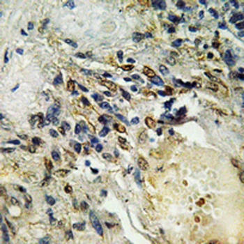 ETS1 rabbit pAb Antibody