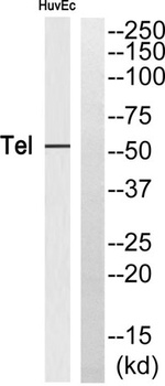 TEL rabbit pAb Antibody