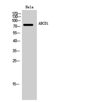 ABCD1 rabbit pAb Antibody