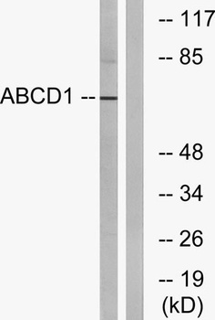 ABCD1 rabbit pAb Antibody
