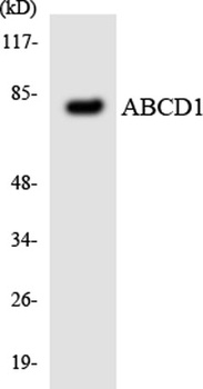 ABCD1 rabbit pAb Antibody