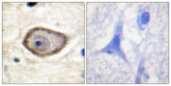 TF (phospho Ser290) rabbit pAb Antibody