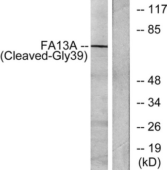 Cleaved-Factor XIIIa (G39) rabbit pAb Antibody