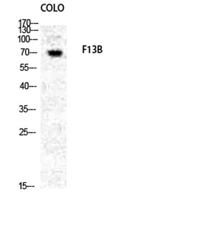 Factor XIII B rabbit pAb Antibody