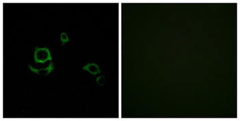Factor XIII B rabbit pAb Antibody