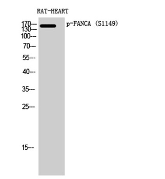 FANCA (phospho Ser1149) rabbit pAb Antibody