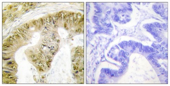 FANCA (phospho Ser1149) rabbit pAb Antibody