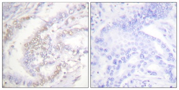 FANCD2 (phospho Ser222) rabbit pAb Antibody