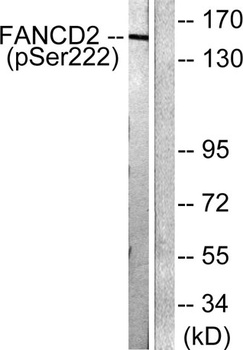 FANCD2 (phospho Ser222) rabbit pAb Antibody
