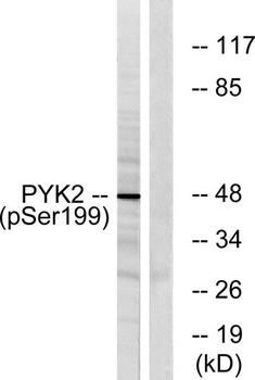 PYK2 (phospho Tyr402) rabbit pAb Antibody