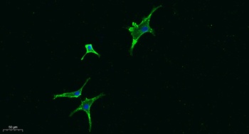 Seprase rabbit pAb Antibody