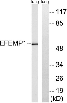 Fibulin-3 rabbit pAb Antibody