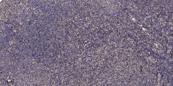 Fibulin-3 rabbit pAb Antibody