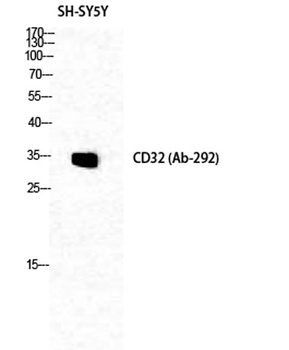 CD32 rabbit pAb Antibody