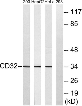 CD32 rabbit pAb Antibody