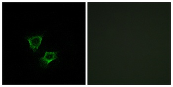 ZNRF2 rabbit pAb Antibody