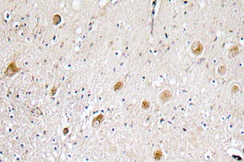 FGF-1 rabbit pAb Antibody