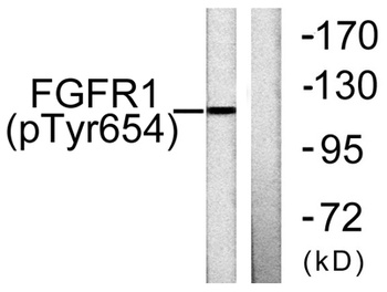 Flg (phospho Tyr654) rabbit pAb Antibody