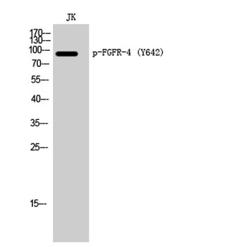 FGFR-4 (phospho Tyr642) rabbit pAb Antibody