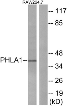 TDAG51 rabbit pAb Antibody