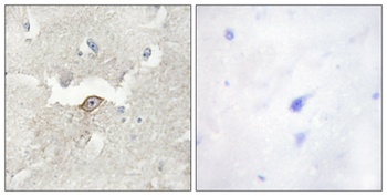 KPI-2 rabbit pAb Antibody