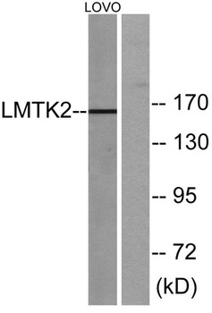 KPI-2 rabbit pAb Antibody