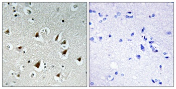 ZHX2 rabbit pAb Antibody