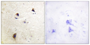Rabphilin-3A (phospho Ser237) rabbit pAb Antibody