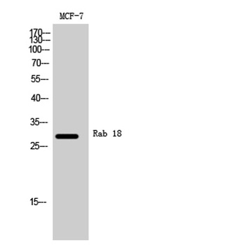 Rab 18 rabbit pAb Antibody