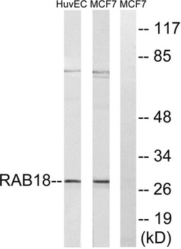 Rab 18 rabbit pAb Antibody