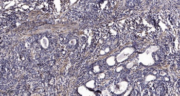 Rab 18 rabbit pAb Antibody