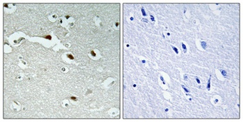FoxJ1 rabbit pAb Antibody