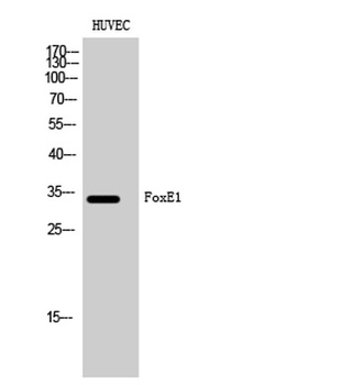 FoxE1 rabbit pAb Antibody