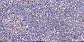 FoxE1 rabbit pAb Antibody