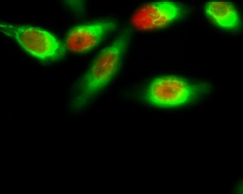 FoxO1 (phospho Ser256) rabbit pAb Antibody