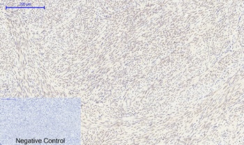 FoxO1 rabbit pAb Antibody