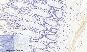 FoxO3A (phospho Ser253) rabbit pAb Antibody