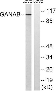 Glucosidase IIα rabbit pAb Antibody