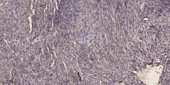 Glucosidase IIα rabbit pAb Antibody