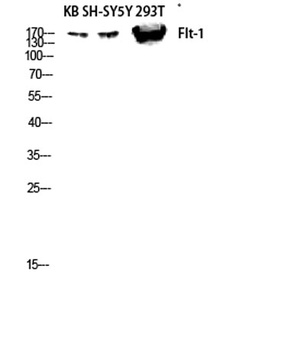 Flt-1 rabbit pAb Antibody