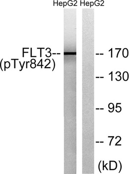 Flt-3 (phospho Tyr842) rabbit pAb Antibody