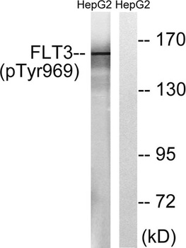 Flt-3 (phospho Tyr969) rabbit pAb Antibody