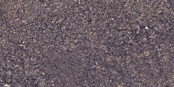 SF3b130 rabbit pAb Antibody