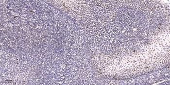 HRT2 rabbit pAb Antibody