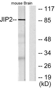JIP-2 rabbit pAb Antibody