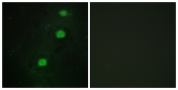 CCRK rabbit pAb Antibody