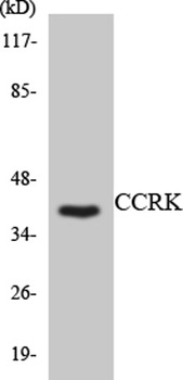 CCRK rabbit pAb Antibody
