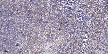 CCRK rabbit pAb Antibody